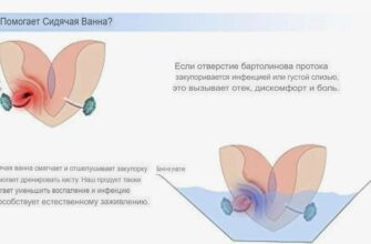 лечение бартолиновой кисты без операции
